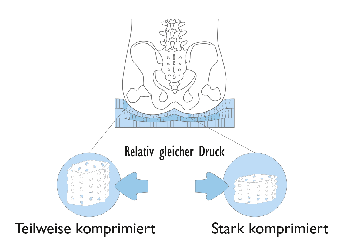 Druckverteilung 1 1